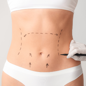 Post-Op Lymphatic Drainage For Cosmetic Surgery